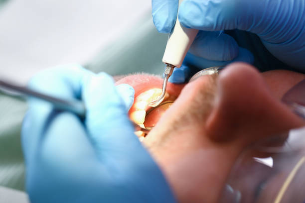 Best Emergency Dentist for Knocked-Out Tooth in Porters Neck, NC